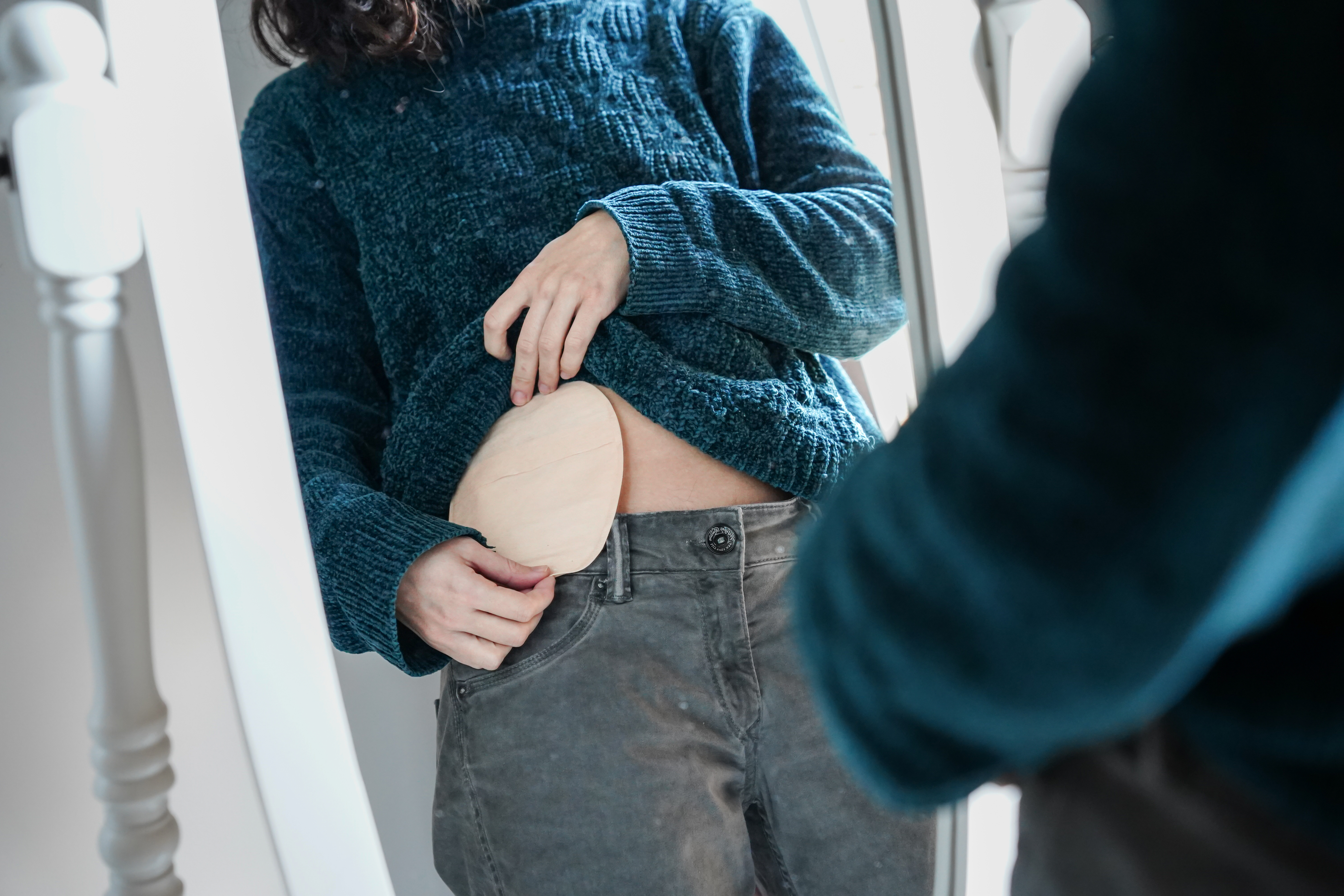 Nahaufnahme des Unterleibs einer Person, die diskret einen Stomabeutel unter der Kleidung trägt. Symbolisiert professionelle und empathische Stomatherapie und Homecare-Versorgung.